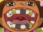 虫歯がいっぱいの子供を治す歯医者さんゲーム：Dora Dentist Day